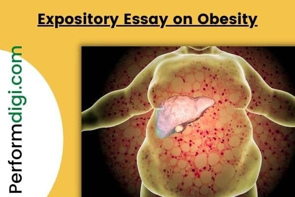 essay on obesity management in 300 words